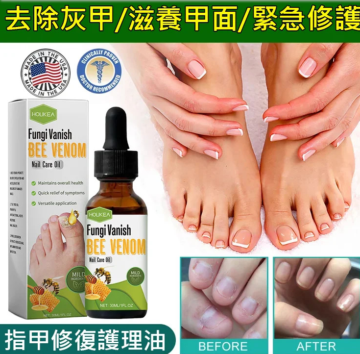 【美國進口】7天修灰指甲治療專用修復液 甲溝炎殺菌液抗菌 灰指甲真菌治療液，無需拔甲，修 復指甲，只除病甲，不傷好甲，治療灰指甲，永不復發