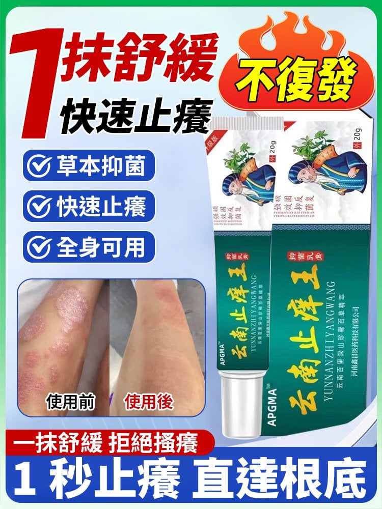 【1秒止癢_直達根底！】草本抑菌膏_一抹舒緩_拒絕瘙癢，皮膚瘙癢外用本草膏