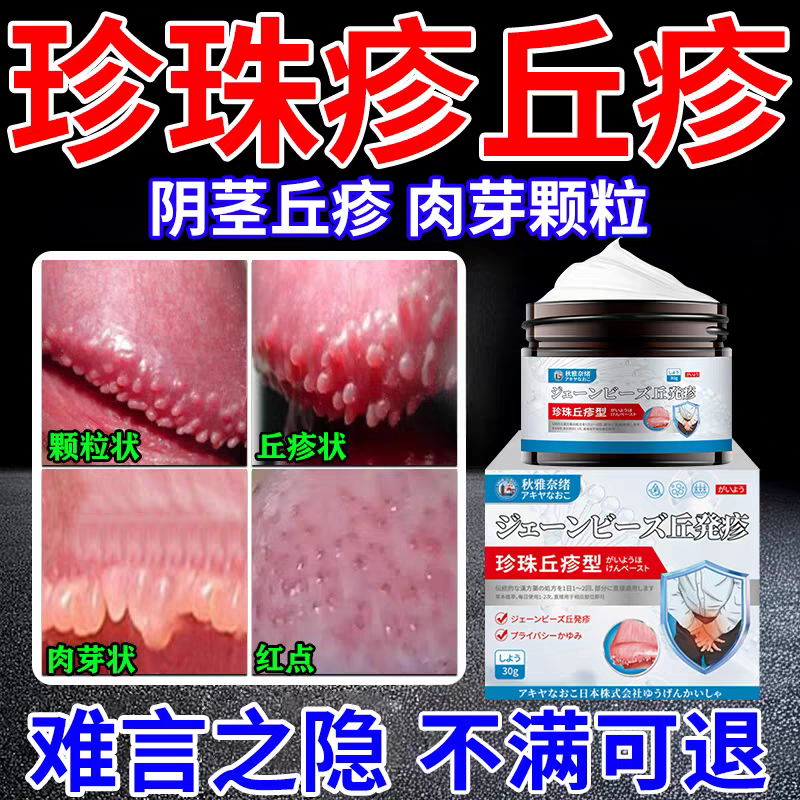 【秋雅奈緒珍珠丘疹膏 】 男女私處瘙癢， 疹子，脫皮，潰爛等私處用藥